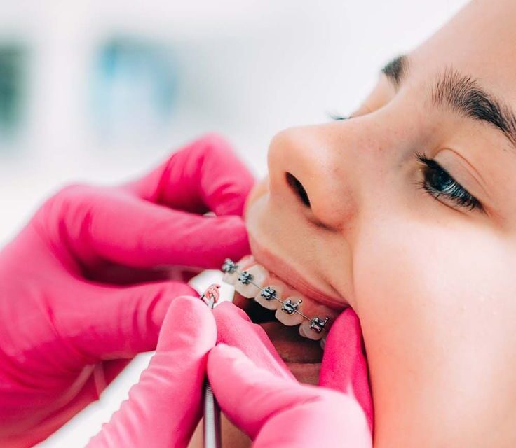 Más allá de una sonrisa bonita, una decisión que mejora tu salud